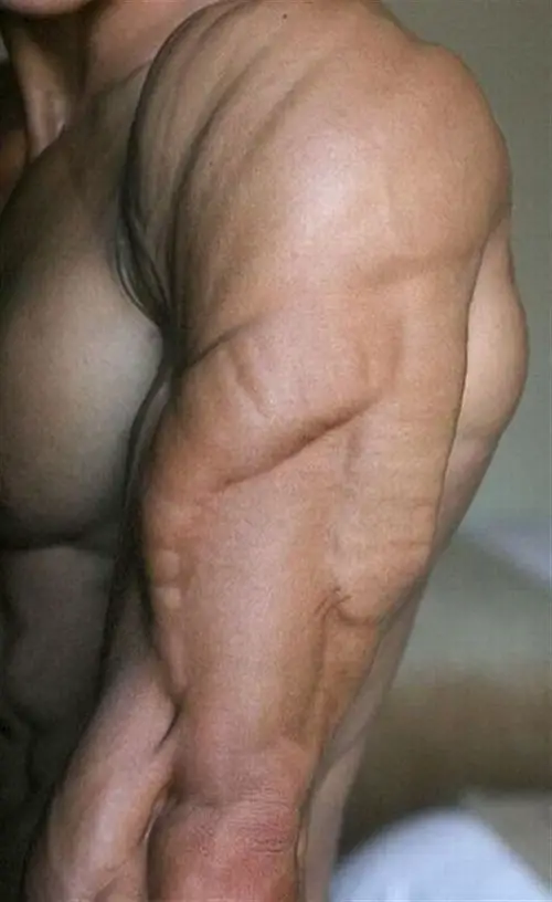 Funny Picture - Tricep Or Alien Invader? You Decide.