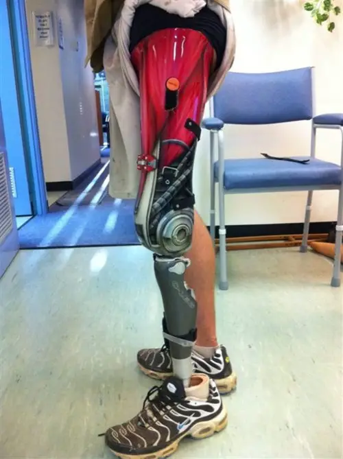 Funny Picture - Prosthetic Paint Job