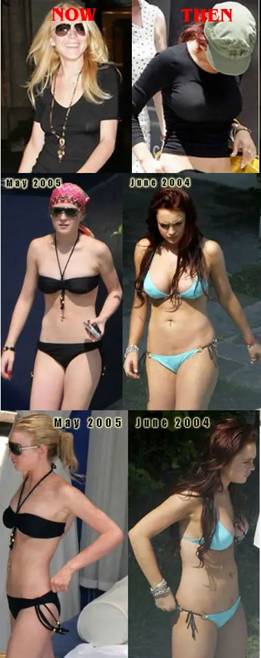 Funny Picture - Lindsay Lohan - Then And Now